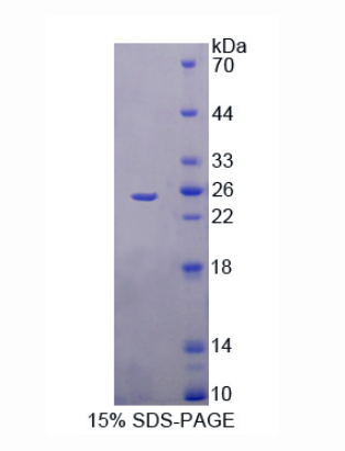 海藻糖酶(TREH)重组蛋白,Recombinant Trehalase (TREH)