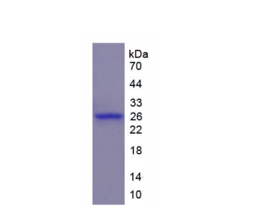 WNT1诱导信号通道蛋白2(WISP2)重组蛋白,Recombinant WNT1 Inducible Signaling Pathway Protein 2 (WISP2)