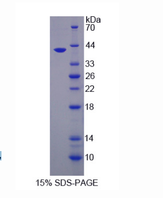 尿嘧啶DNA糖基化酶(UNG)重組蛋白,Recombinant Uracil DNA Glycosylase (UNG)