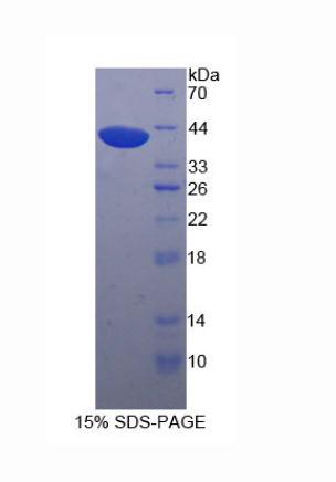 尿苷二磷酸糖基转移酶8(UGT8)重组蛋白,Recombinant UDP Glycosyltransferase 8 (UGT8)