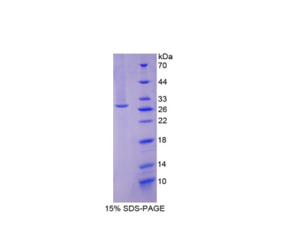 泛素羧基端酯酶L1(UCHL1)重组蛋白,Recombinant Ubiquitin Carboxyl Terminal Hydrolase L1 (UCHL1)