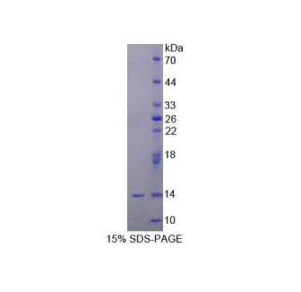 泛醌蛋白2(UBQLN2)重组蛋白,Recombinant Ubiquilin 2 (UBQLN2)