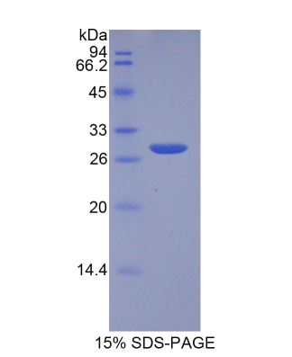 翻译调节肿瘤蛋白1(TPT1)重组蛋白,Recombinant Tumor Protein, Translationally Controlled 1 (TPT1)