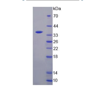 胸苷酸合成酶(TYMS)重組蛋白,Recombinant Thymidylate Synthetase (TYMS)