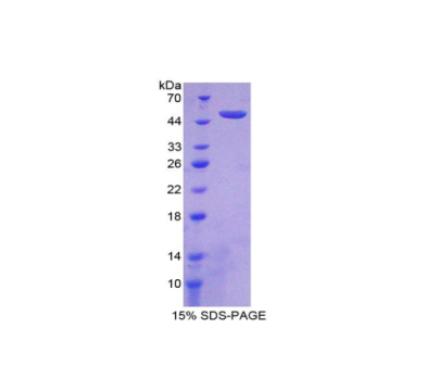 干擾素α21(IFNa21)重組蛋白,Recombinant Interferon Alpha 21 (IFNa21)