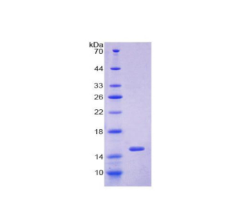 谷氧還蛋白(GLRX)重組蛋白,Recombinant Glutaredoxin (GLRX)