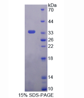 丙糖磷酸異構(gòu)酶1(TPI1)重組蛋白,Recombinant Triosephosphate Isomerase 1 (TPI1)