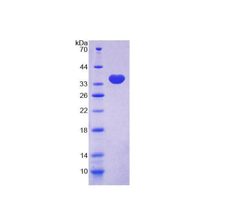 踝蛋白2(TLN2)重组蛋白,Recombinant Talin 2 (TLN2)