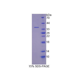 转酮醇酶(TKT)重组蛋白,Recombinant Transketolase (TKT)