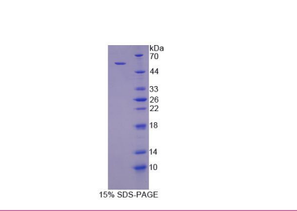 反式高尔基体网状结构蛋白2(TGOLN2)重组蛋白,Recombinant Trans Golgi Network Protein 2 (TGOLN2)