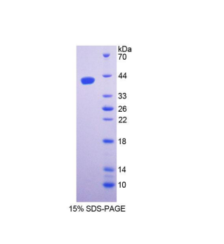 絲氨酸棕櫚酰轉(zhuǎn)移酶長鏈堿性亞基1(SPTLC1)重組蛋白,Recombinant Serine Palmitoyltransferase, Long Chain Base Subunit 1 (SPTLC1)