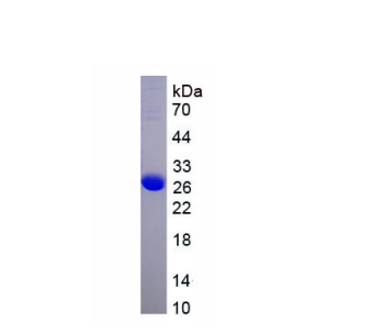 细胞因子信号转导抑制因子1(SOCS1)重组蛋白,Recombinant Suppressors Of Cytokine Signaling 1 (SOCS1)