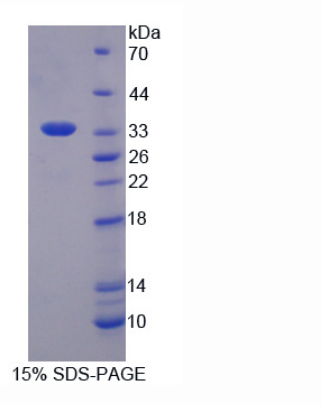 單鏈選擇性單功能尿嘧啶DNA糖基化酶1(SMUG1)重組蛋白,Recombinant Single Strand Selective Monofunctional Uracil DNA Glycosylase 1 (SMUG1)