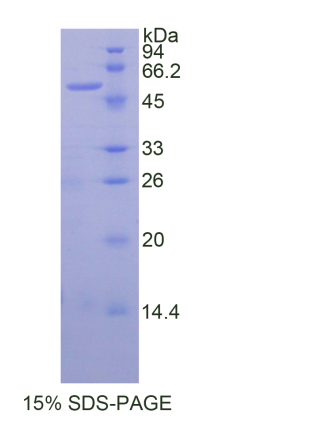 唾液酸乙酰酯酶(SIAE)重组蛋白,Recombinant Sialic Acid Acetylesterase (SIAE)