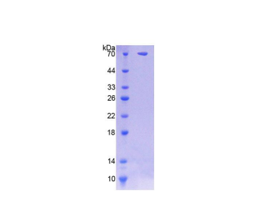 N-磺氨基葡糖磺基氢化酶(SGSH)重组蛋白,Recombinant N-Sulfoglucosamine Sulfohydrolase (SGSH)