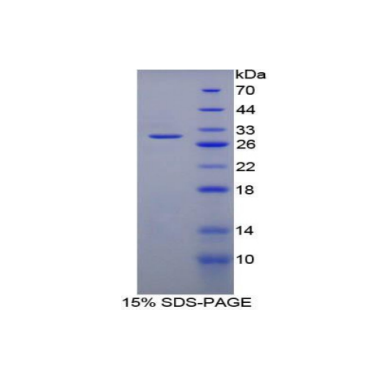 分层蛋白(SFN)重组蛋白,Recombinant Stratifin (SFN)