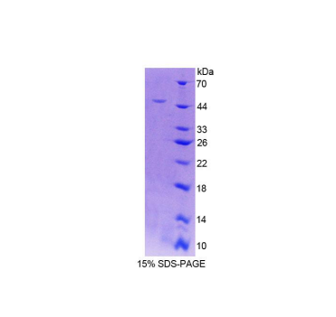 核黄素激酶(RFK)重组蛋白,Recombinant Riboflavin Kinase (RFK)