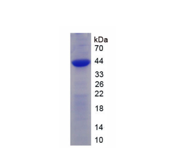 受体活性修饰蛋白2(RAMP2)重组蛋白,Recombinant Receptor Activity Modifying Protein 2 (RAMP2)