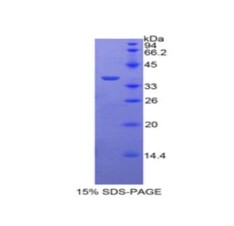 旁血小板溶蛋白(PPL)重组蛋白,Recombinant Periplakin (PPL)