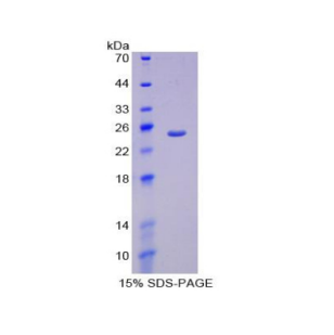 过氧化物酶体增殖物激活受体γ辅激活因子1α(PPARgC1a)重组蛋白,Recombinant Peroxisome Proliferator Activated Receptor Gamma Coactivator 1 Alpha (PPARgC1a)