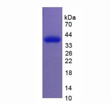 质膜膜泡关联蛋白(PLVAP)重组蛋白,Recombinant Plasmalemma Vesicle Associated Protein (PLVAP)