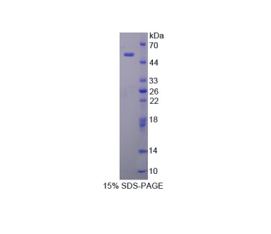 腭/肺/鼻上皮癌關(guān)聯(lián)蛋白(PLUNC)重組蛋白,Recombinant Palate/Lung And Nasal Epithelium Associated Protein (PLUNC)