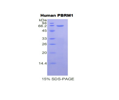 多溴蛋白1(PBRM1)重组蛋白,Recombinant Polybromo 1 (PBRM1)