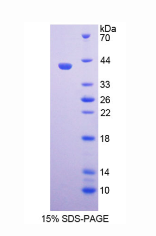 配对框基因9(PAX9)重组蛋白,Recombinant Paired Box Gene 9 (PAX9)