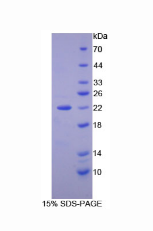 核氧化還原蛋白(NXN)重組蛋白,Recombinant Nucleoredoxin (NXN)