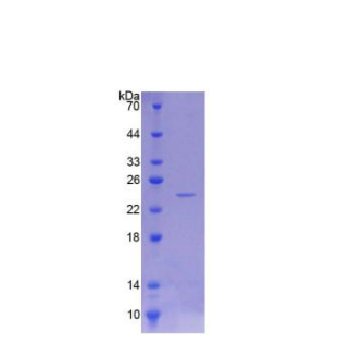 神经疾病靶标酯酶(NTE)重组蛋白,Recombinant Neuropathy Target Esterase (NTE)