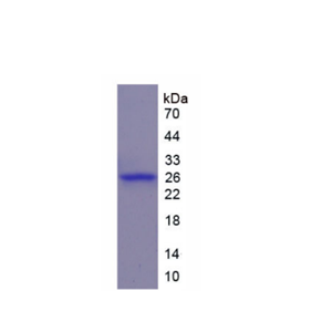 WNT1诱导信号通道蛋白2(WISP2)重组蛋白