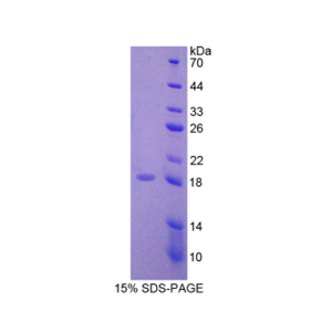 WNT1诱导信号通道蛋白1(WISP1)重组蛋白,Recombinant WNT1 Inducible Signaling Pathway Protein 1 (WISP1)