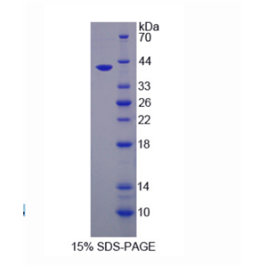 尿嘧啶DNA糖基化酶(UNG)重组蛋白