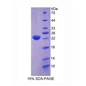 应激诱导磷蛋白1(STIP1)重组蛋白