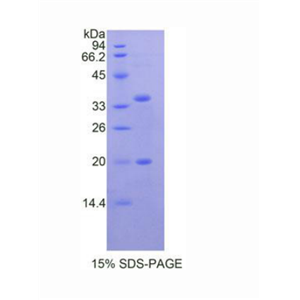 丝氨酸肽酶抑制因子Kazal型5(SPINK5)重组蛋白,Recombinant Serine Peptidase Inhibitor Kazal Type 5 (SPINK5)