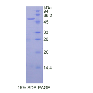 唾液酸乙酰酯酶(SIAE)重组蛋白
