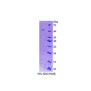 核黄素激酶(RFK)重组蛋白,Recombinant Riboflavin Kinase (RFK)