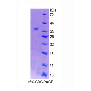 网钙蛋白2(RCN2)重组蛋白