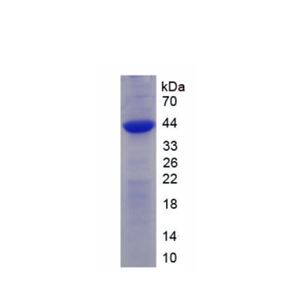 受体活性修饰蛋白2(RAMP2)重组蛋白