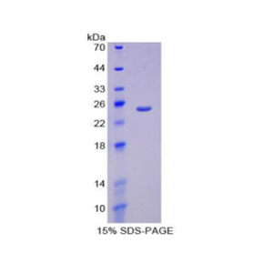 过氧化物酶体增殖物激活受体γ辅激活因子1α(PPARgC1a)重组蛋白