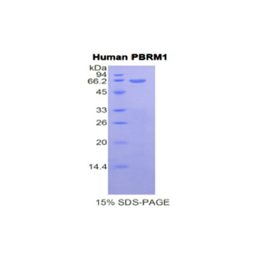 多溴蛋白1(PBRM1)重组蛋白,Recombinant Polybromo 1 (PBRM1)