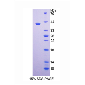 配对框基因9(PAX9)重组蛋白