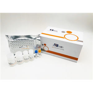 大鼠硫氧还蛋白还原酶(TrxR)Elisa试剂盒