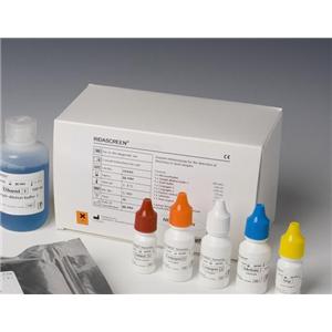 大鼠糖皮质类固醇受体(GR)Elisa试剂盒
