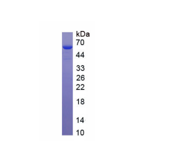 尼克酰胺-N-甲基轉(zhuǎn)移酶(NNMT)重組蛋白,Recombinant Nicotinamide-N-Methyltransferase (NNMT)