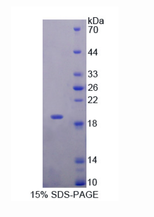 Neudesin神经营养因子(NENF)重组蛋白,Recombinant Neudesin Neurotrophic Factor (NENF)