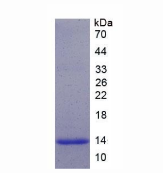 神经源素3(NEUROG3)重组蛋白,Recombinant Neurogenin 3 (NEUROG3)