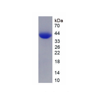 神经源性分化蛋白6(NEUROD6)重组蛋白,Recombinant Neurogenic Differentiation 6 (NEUROD6)