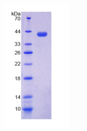 核小体装配蛋白1样1(NAP1L1)重组蛋白,Recombinant Nucleosome Assembly Protein 1 Like Protein 1 (NAP1L1)