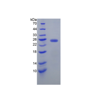 N-乙酰半乳糖胺酶α(NAGa)重组蛋白,Recombinant N-Acetylgalactosaminidase Alpha (NAGa)